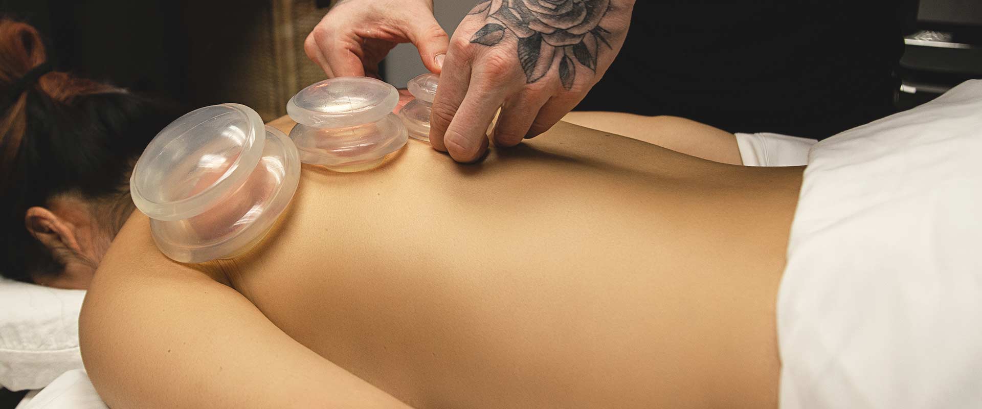 Cupping Massage Therapy | Mount Royal Village Family Chiropractic | Calgary AB